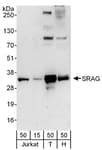 Detection of human SRAG by western blot.