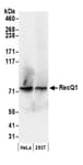 Detection of human RecQ1 by western blot.