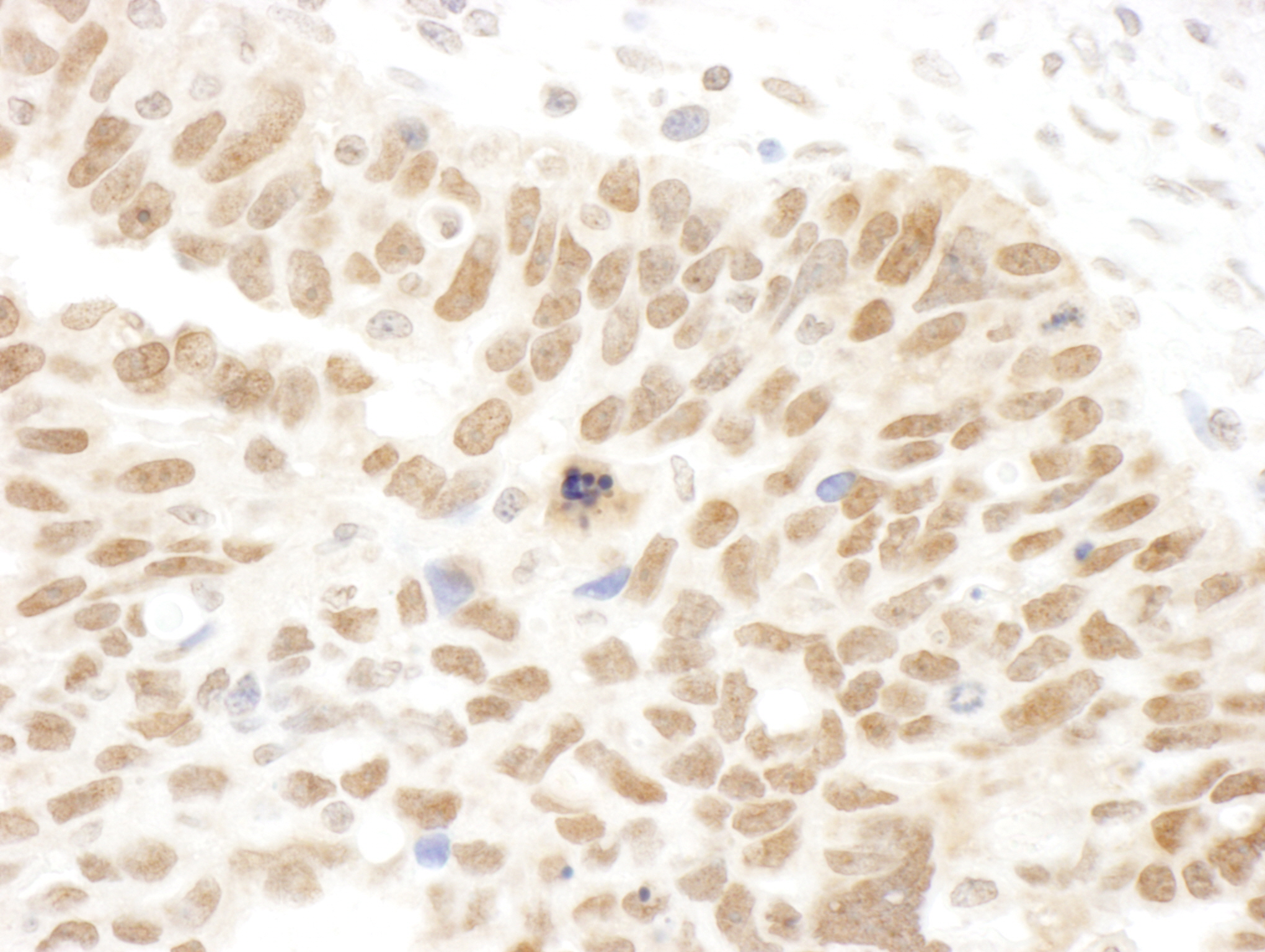 Rabbit anti-Abraxas IHC Antibody