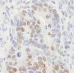 Detection of mouse RCC2 by immunohistochemistry.