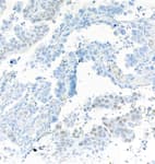 Detection of human SOX2 by immunohistochemistry.