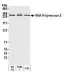 Detection of mouse RNA-Polymerase-2 by western blot.