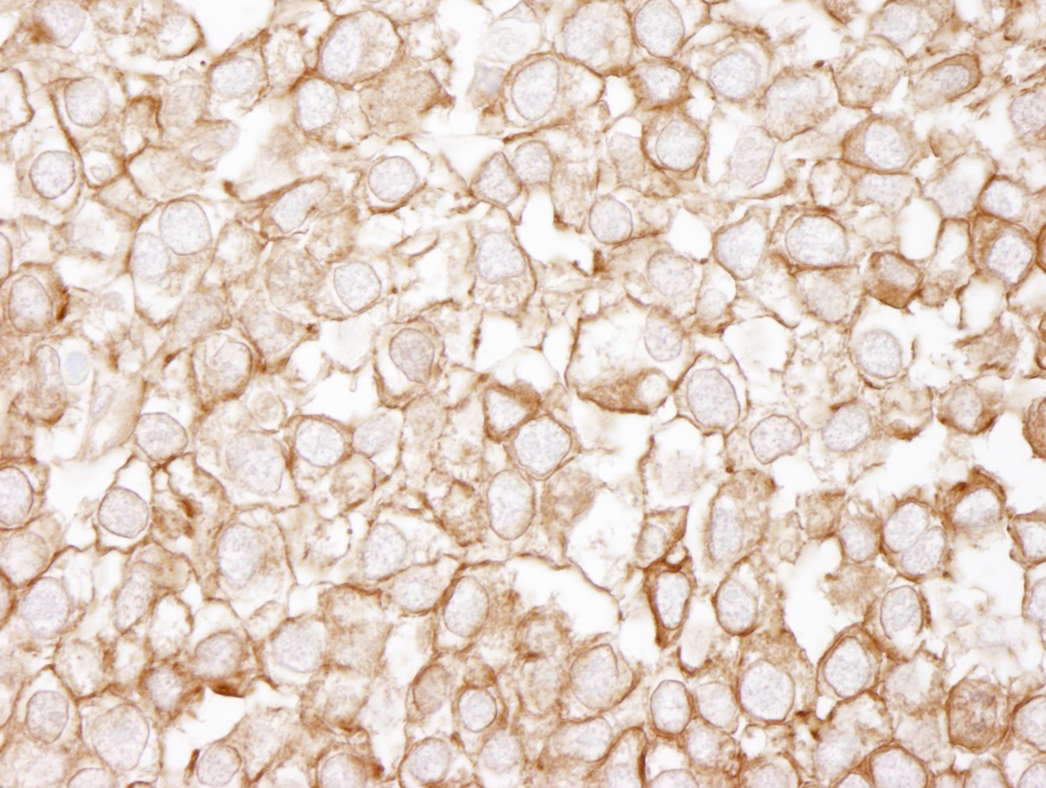 Rabbit anti-eEF2 IHC Antibody