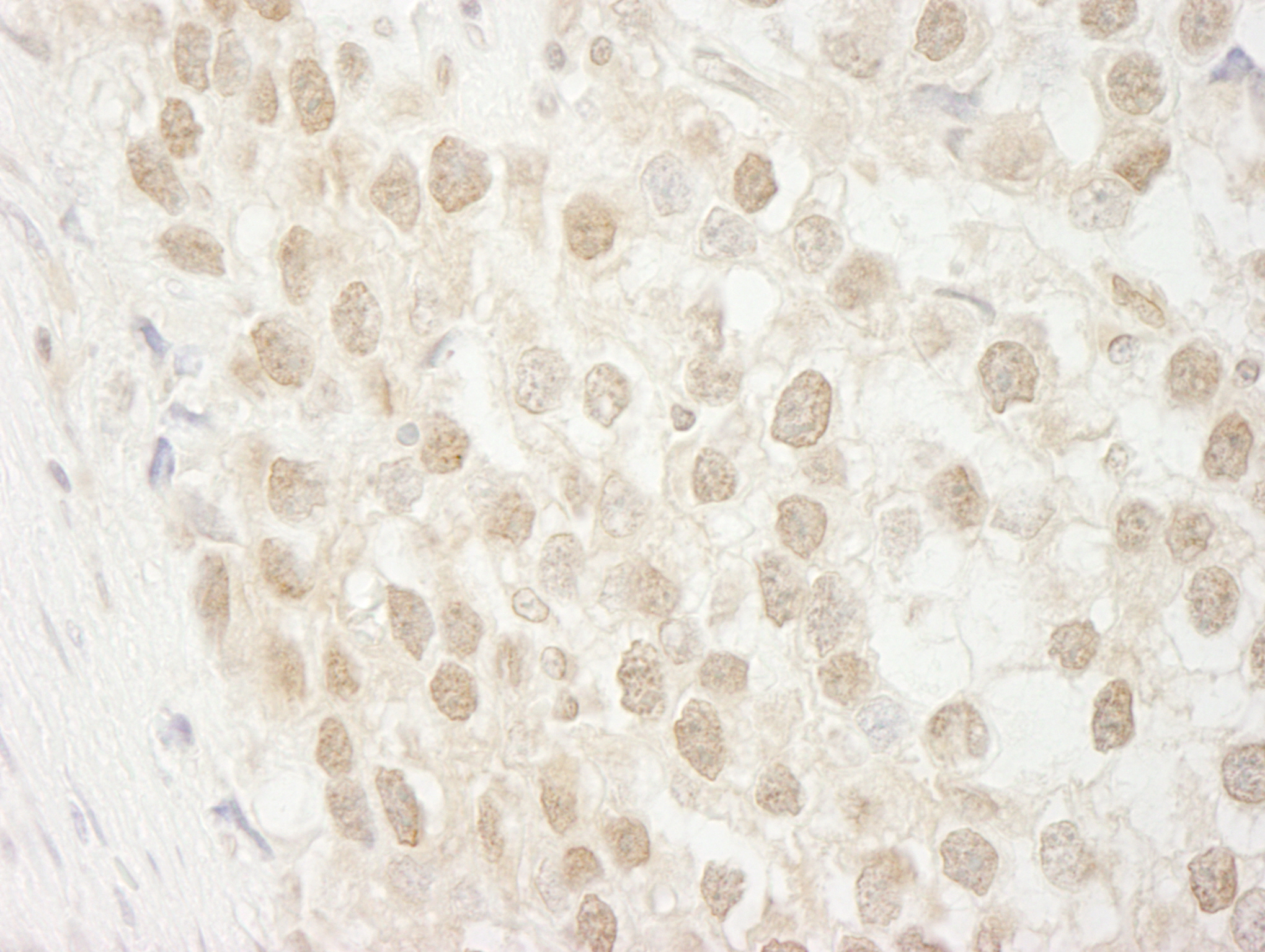 Rabbit anti-MTA3 IHC Antibody