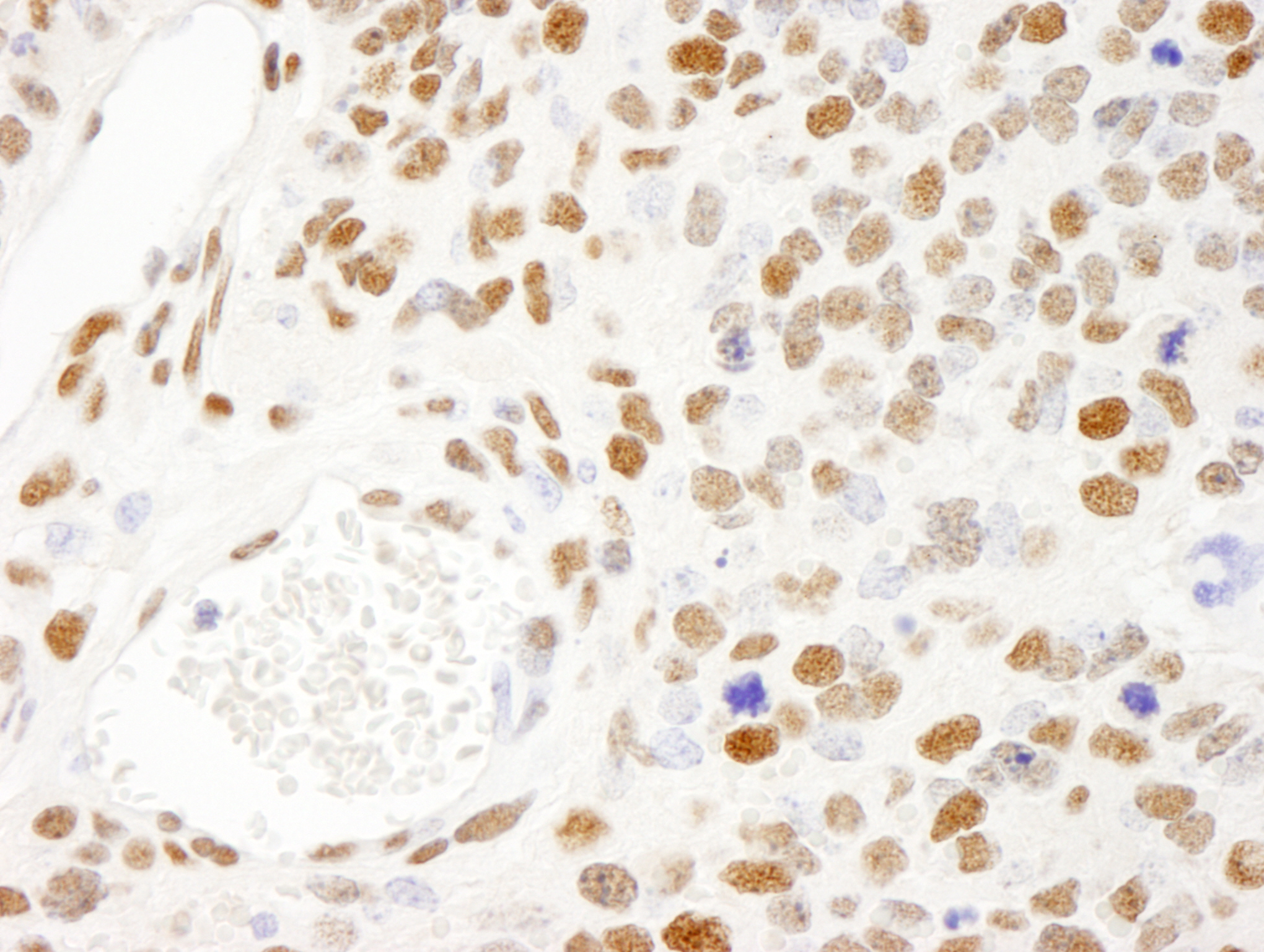 Detection of mouse KSRP by immunohistochemistry.