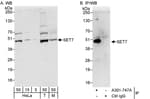 Detection of human and mouse SET7 by western blot (h&amp;m) and immunoprecipitation (h).