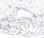 Detection of human CD96 in FFPE testicular seminoma by IHC.