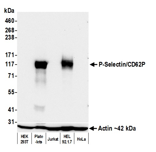 Detection of human P-Selectin/CD62P by western blot.