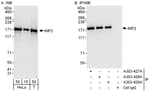 Detection of human INF2 by western blot and immunoprecipitation.
