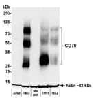 Detection of human CD70 by western blot.