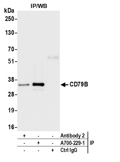 Detection of human CD79B by western blot of immunoprecipitates.