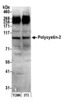 Detection of mouse Polycystin-2 by western blot.