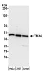 Detection of human TMX4 by western blot.