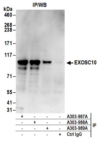 Detection of human EXOSC10 by western blot of immunoprecipitates.