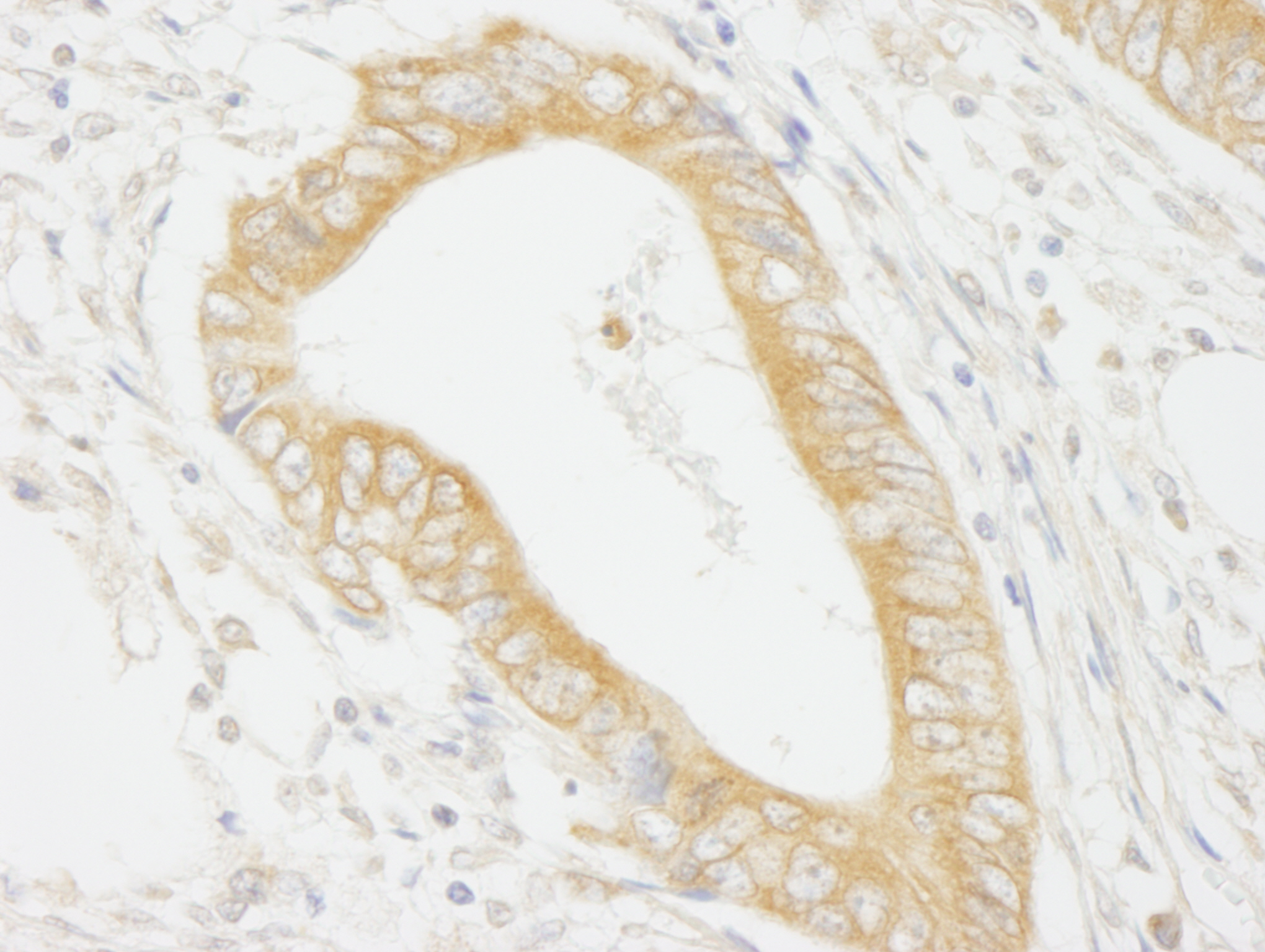Rabbit anti-MAP4K4/HGK IHC Antibody