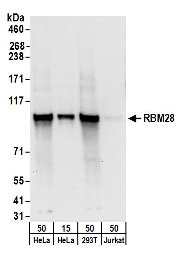 Detection of human RBM28 by western blot.
