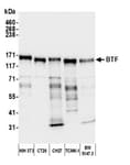 Detection of mouse BTF by western blot.