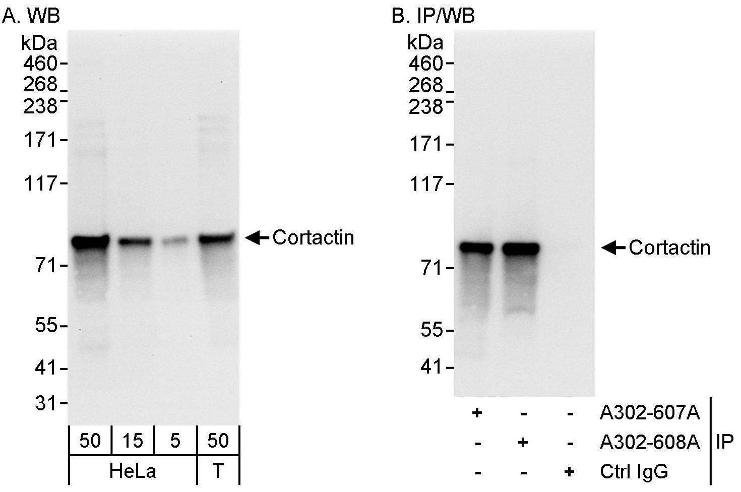 Detection of human Cortactin by western blot and immunoprecipitation.