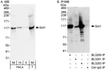 Detection of human Sirt1 by western blot and immunoprecipitation.