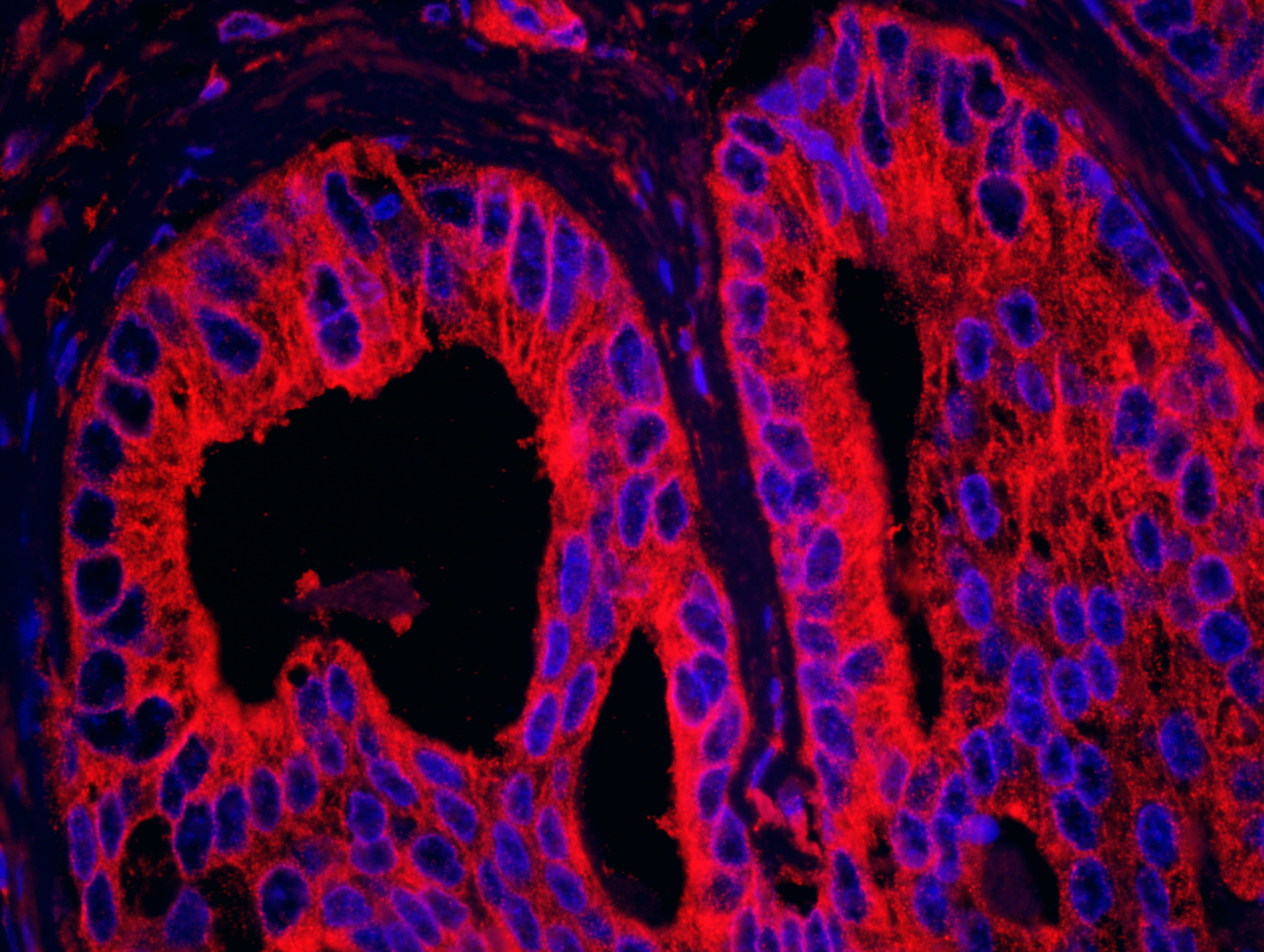 Detection of human EB1 by immunohistochemistry.