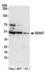 Detection of human and mouse DDX47 by western blot.