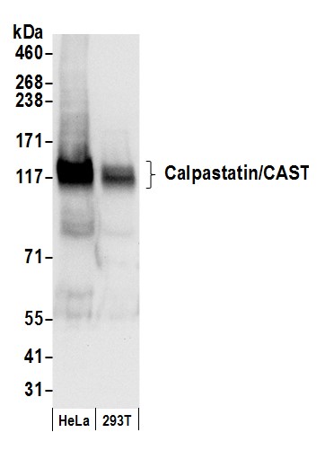 Detection of human Calpastatin/CAST by western blot.