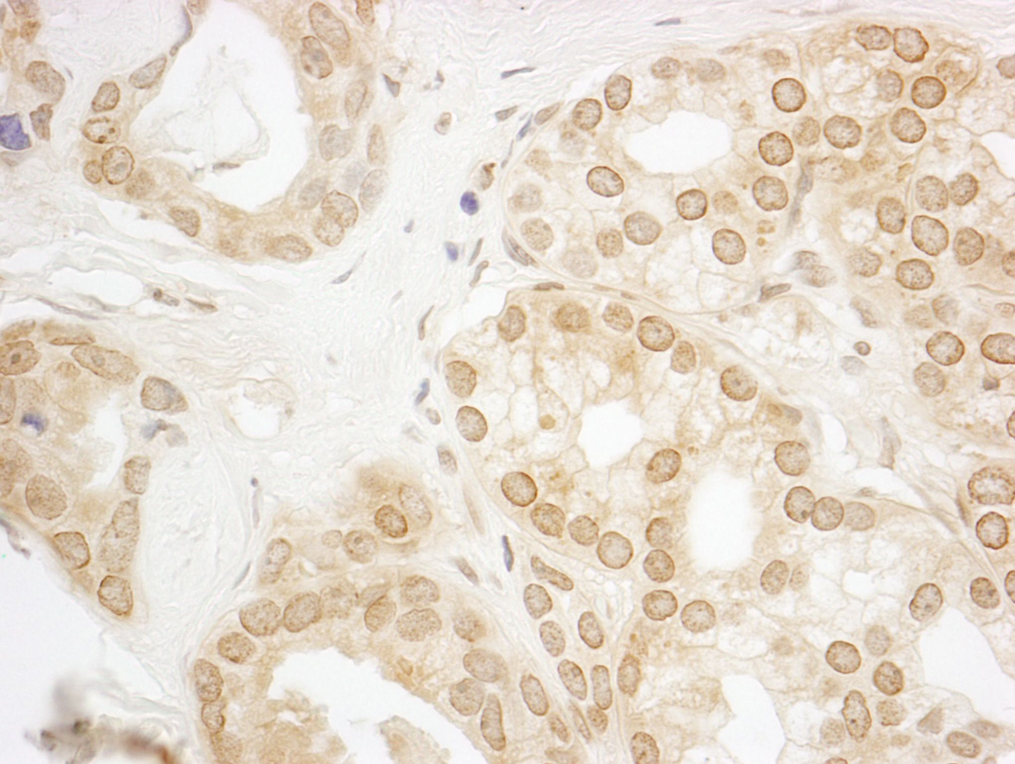 Rabbit anti-PPP3CA IHC Antibody