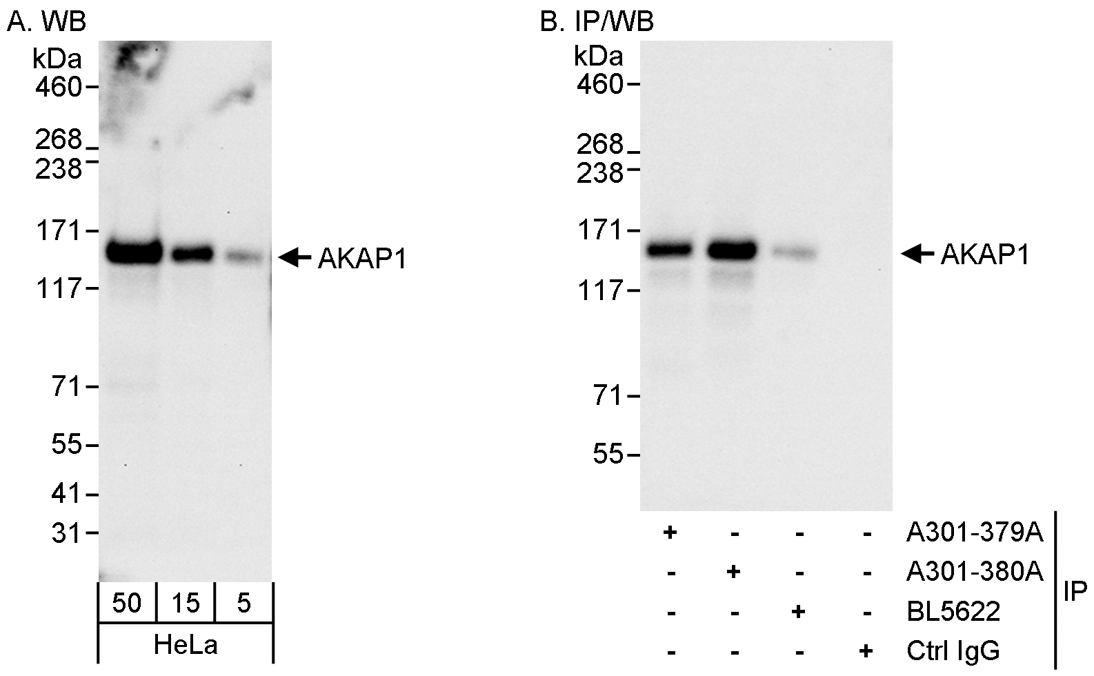 Detection of human AKAP1 by western blot and immunoprecipitation.