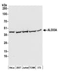 Detection of human and mouse ALDOA by western blot.