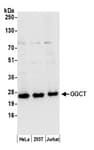 Detection of human GGCT by western blot.