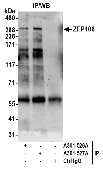 Detection of human ZFP106 by western blot of immunoprecipitates.