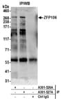Detection of human ZFP106 by western blot of immunoprecipitates.