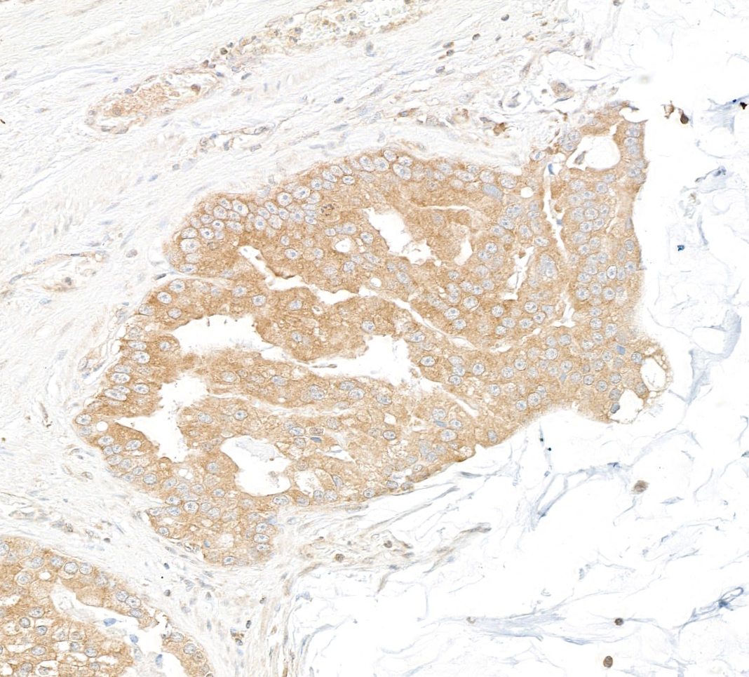 Detection of human DDX6 by immunohistochemistry.