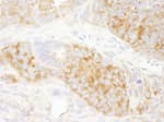 Detection of mouse RPS6 by immunohistochemistry.