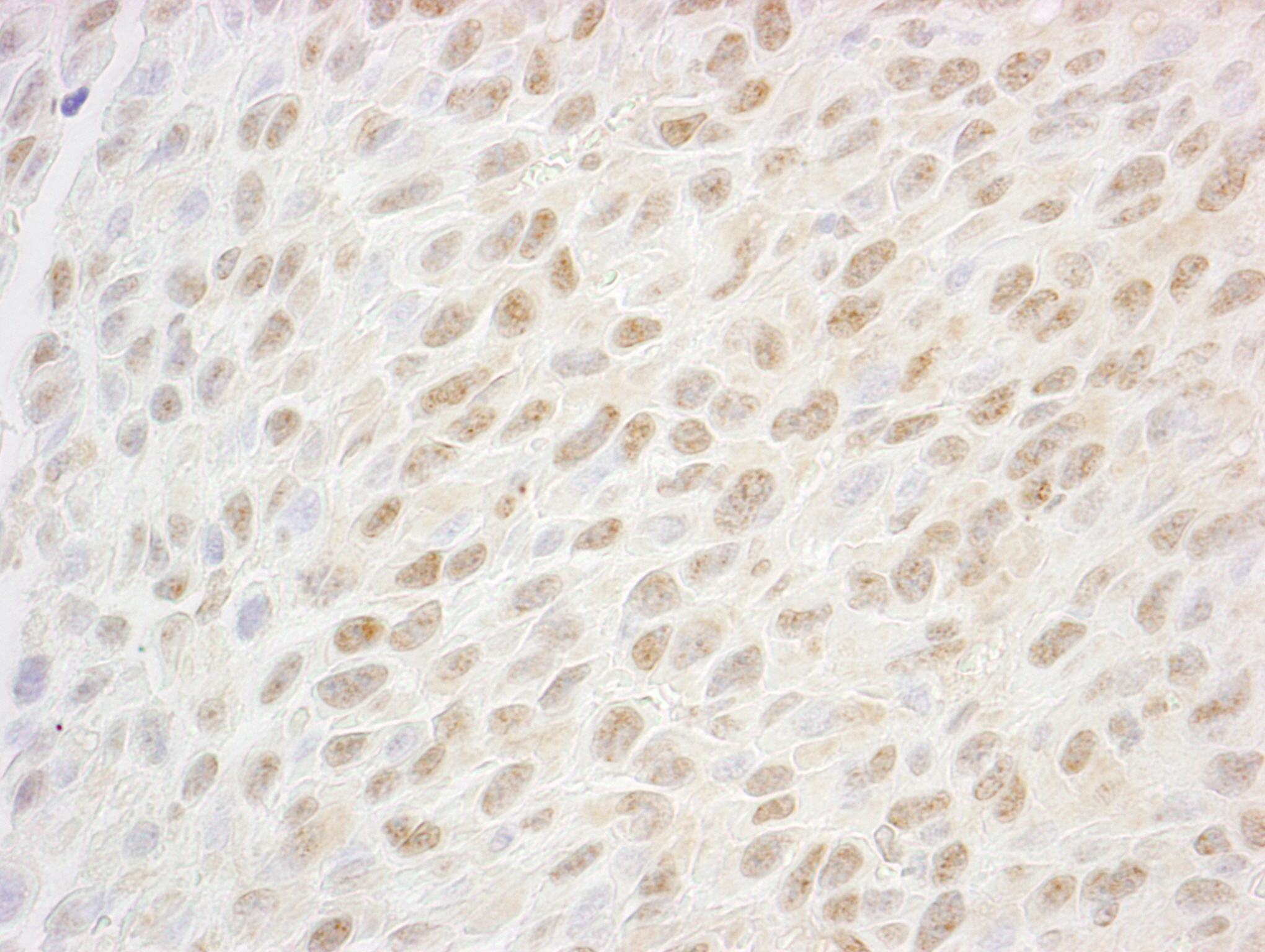 Detection of mouse SSB1 by immunohistochemistry.