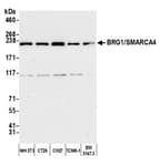 Detection of mouse BRG1/SMARCA4 by western blot.