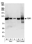 Detection of human TOP1 by western blot.