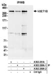 Detection of human hSET1B by western blot of immunoprecipitates.