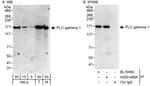 Detection of human and mouse PLC-gamma 1 by western blot (h&amp;m) and immunoprecipitation (h).