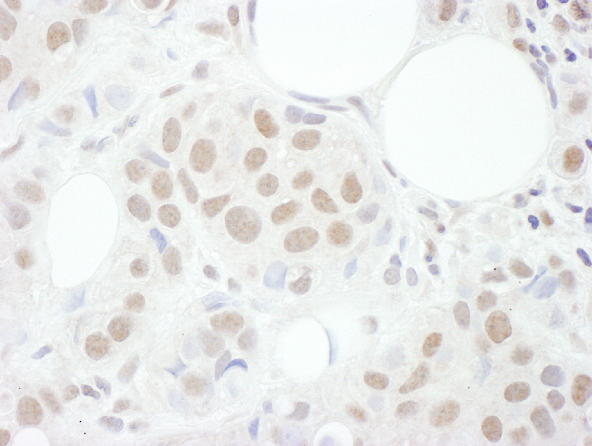 Detection of human Cyclin T1 by immunohistochemistry.