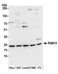 Detection of human and mouse RAB10 by western blot.