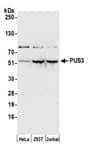 Detection of human PUS3 by western blot.