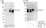 Detection of human STAM1 by western blot and immunoprecipitation.