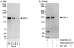 Detection of human MKL1 by western blot and immunoprecipitation.