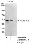 Detection of human CaMKI delta by western blot of immunoprecipitates.