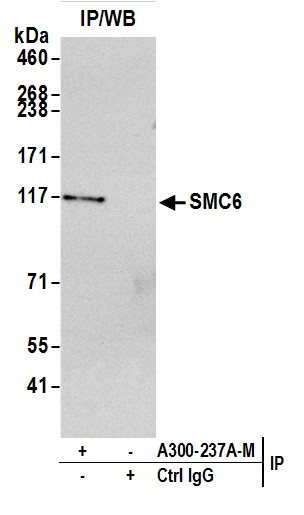 Rabbit anti-SMC6 Antibody, Affinity Purified