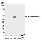 Detection of mouse and rat Neurofilament-L by western blot.