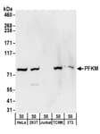 Detection of human and mouse PFKM by western blot.