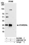 Detection of human STARD3NL by western blot of immunoprecipitates.