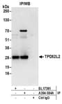 Detection of human TPD52L2 by western blot of immunoprecipitates.